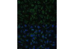 Immunofluorescence analysis of L929 cells using A Polyclonal Antibody (ABIN7265628) at dilution of 1:100 (40x lens). (APH1A antibody  (C-Term))
