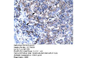 Human Liver (T-Box 19 antibody  (N-Term))