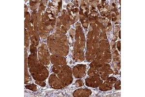 Immunohistochemical staining of human stomach upper with ST3GAL6 polyclonal antibody ( Cat # PAB28018 ) shows strong cytoplasmic positivity in glandular cells. (ST3GAL6 antibody)