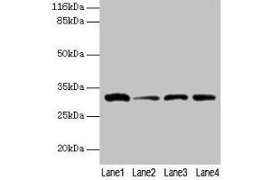 Western blot All lanes: GSTK1 antibody at 2 μg/mL Lane 1: 293T whole cell lysate Lane 2: Hela whole cell lysate Lane 3: A431 whole cell lysate Lane 4: COLO205 whole cell lysate Secondary Goat polyclonal to rabbit IgG at 1/10000 dilution Predicted band size: 26, 32, 25, 21 kDa Observed band size: 32 kDa (GSTK1 antibody  (AA 2-226))