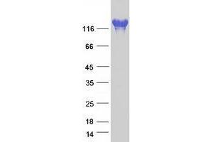 Validation with Western Blot (IGSF3 Protein (Transcript Variant 2) (Myc-DYKDDDDK Tag))