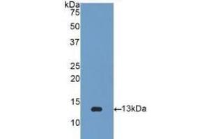 Detection of Recombinant b2M, Human using Polyclonal Antibody to Beta-2-Microglobulin (b2M) (beta-2 Microglobulin antibody  (AA 22-119))