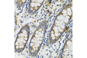 Immunohistochemistry of paraffin-embedded human colon using DEFB132 antibody (ABIN6293281) at dilution of 1:100 (40x lens). (DEFB132 antibody)