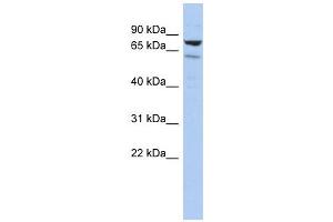 C1ORF103 antibody used at 1 ug/ml to detect target protein. (C1orf103 antibody  (Middle Region))