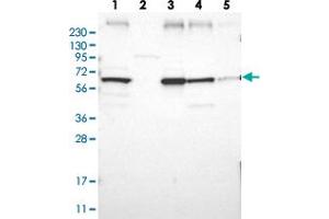 Western blot analysis of Lane 1: RT-4, Lane 2: Human Plasma, Lane 3: U-251 MG, Lane 4: Liver, Lane 5: Tonsil with CLCC1 polyclonal antibody  at 1:250-1:500 dilution.