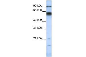 WB Suggested Anti-MMAntibody Titration:  0. (MMP16 antibody  (N-Term))