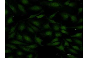 Immunofluorescence of monoclonal antibody to SMAD7 on HeLa cell. (SMAD7 antibody  (AA 160-260))
