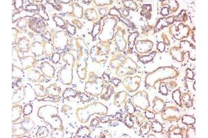 Formalin-fixed and paraffin embedded human kidney labeled with Rabbit Anti-5HT3B receptor Polyclonal Antibody, Unconjugated  at 1:200 followed by conjugation to the secondary antibody and DAB staining (Serotonin Receptor 3B antibody  (AA 101-200))
