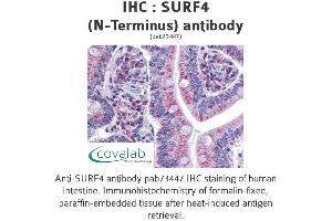 Image no. 2 for anti-Surfeit 4 (SURF4) (N-Term) antibody (ABIN1739778) (Surfeit 4 antibody  (N-Term))