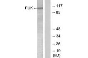 Western blot analysis of extracts from COS7 cells, treated with insulin 0. (FUK antibody  (AA 11-60))