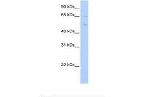 Image no. 1 for anti-Copine IV (CPNE4) (AA 396-445) antibody (ABIN6738839) (Copine IV antibody  (AA 396-445))
