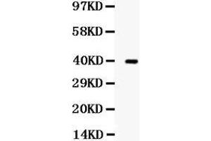 Western blot analysis of TRIB2 expression in SW620 whole cell lysates (lane 1). (TRIB2 antibody  (Middle Region))