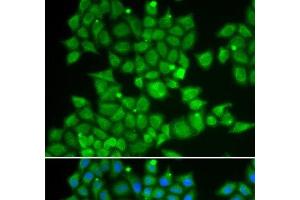 Immunofluorescence analysis of U2OS cells using PDE1B Polyclonal Antibody (PDE1B antibody)