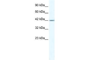 WB Suggested Anti-ZNF70 Antibody Titration:  5.