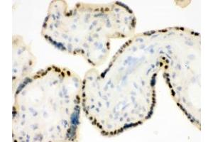 Immunohistochemistry (IHC) image for anti-Damage Specific DNA Binding Protein 1 (DDB1) (AA 1011-1140) antibody (ABIN4950780)
