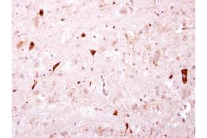 IHC-P Image BTD antibody [N3C3] detects BTD protein at cytosol on mouse hind brain by immunohistochemical analysis. (BTD antibody)