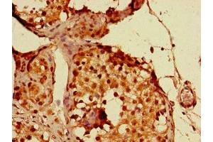 Immunohistochemistry of paraffin-embedded human testis tissue using ABIN7144480 at dilution of 1:100 (PPP1R13B antibody  (AA 375-675))