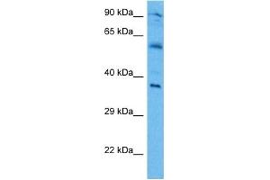 Host:  Mouse  Target Name:  IRF1  Sample Tissue:  Mouse Brain  Antibody Dilution:  1ug/ml (IRF1 antibody  (Middle Region))
