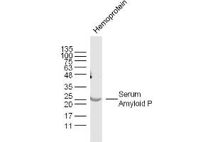 Mouse hemoprotein lysates probed with Serum Amyloid P Polyclonal Antibody, Unconjugated  at 1:300 dilution and 4˚C overnight incubation. (APCS antibody  (AA 31-130))