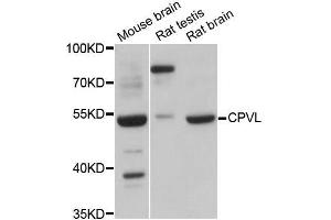 Western blot analysis of extracts of various cell lines, using CPVL antibody (ABIN5997510) at 1:3000 dilution.