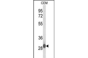 Western blot analysis of C15orf29 Antibody (N-term) (ABIN653523 and ABIN2842923) in CEM cell line lysates (35 μg/lane).