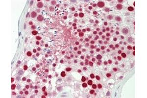 Human Testis: Formalin-Fixed, Paraffin-Embedded (FFPE) (KPNA4 antibody  (AA 471-521))