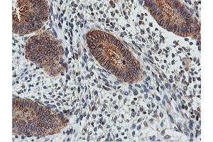 Image no. 7 for anti-Farnesyl-Diphosphate Farnesyltransferase 1 (FDFT1) antibody (ABIN1498243)