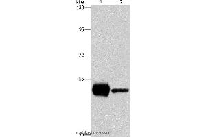 Western blot analysis of K562 and mouse brain tissue, using PIP4K2A Polyclonal Antibody at dilution of 1:1150