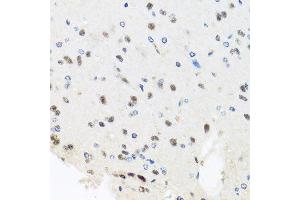 Immunohistochemistry of paraffin-embedded rat brain using PRPF8 antibody. (PRPF8 antibody  (AA 1-100))