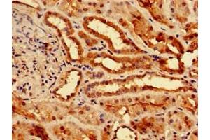 Immunohistochemistry of paraffin-embedded human kidney tissue using ABIN7173369 at dilution of 1:100 (Slc25a1 antibody  (AA 144-182))