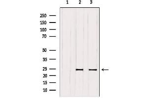 Western blot analysis of extracts from various samples, using RAB6A Antibody. (RAB6A antibody  (Internal Region))