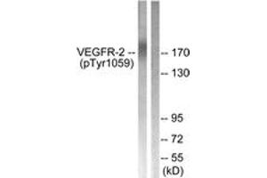Western blot analysis of extracts from HepG2 cells treated with Na3VO4 0. (VEGFR2/CD309 antibody  (pTyr1059))