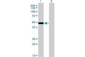 Western Blot analysis of CRLF1 expression in transfected 293T cell line by CRLF1 monoclonal antibody (M01), clone 4F4. (CRLF1 antibody  (AA 135-230))