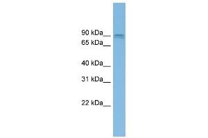 CENTG1 antibody used at 1 ug/ml to detect target protein. (AGAP2 antibody  (Middle Region))