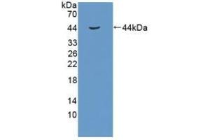 Detection of Recombinant RB1, Human using Polyclonal Antibody to Retinoblastoma Protein 1 (RB1) (Retinoblastoma 1 antibody  (AA 639-778))