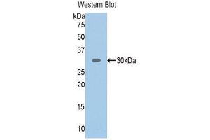 Western Blotting (WB) image for anti-Plastin 3 (PLS3) (AA 379-630) antibody (ABIN1111126) (Plastin 3 antibody  (AA 379-630))