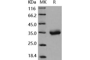 Coxsackie Adenovirus Receptor Protein (His tag)