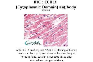 Image no. 1 for anti-Chemokine (C-C Motif) Receptor-Like 1 (CCRL1) (1st Cytoplasmic Domain) antibody (ABIN1732790) (CCRL1 antibody  (1st Cytoplasmic Domain))