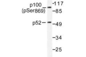 Image no. 1 for anti-Nuclear Factor of kappa Light Polypeptide Gene Enhancer in B-Cells 2 (NFKB2) (pSer869) antibody (ABIN318077)