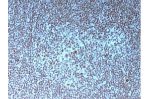 Image no. 3 for anti-Nucleolar / Nucleoli antibody (ABIN6153718) (Nucleolar / Nucleoli antibody)