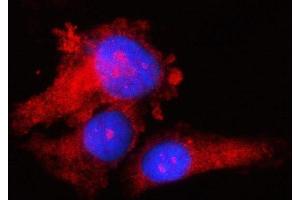 IF analysis of RPS17 using anti-RPS17 antibody (ABIN7598984). (RPS17 antibody  (AA 1-135))