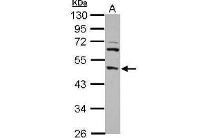 WB Image Sample (30 ug of whole cell lysate) A: PC-3 10% SDS PAGE antibody diluted at 1:1000 (DP2 antibody)