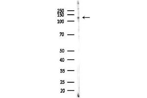 anti-Zinc Finger E-Box Binding Homeobox 2 (ZEB2) (pSer784) antibody
