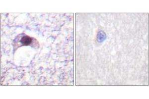 Immunohistochemistry analysis of paraffin-embedded human brain tissue, using E2F6 Antibody. (E2F6 antibody  (AA 141-190))