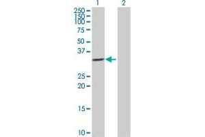 Western Blot analysis of IL1B expression in transfected 293T cell line by IL1B MaxPab polyclonal antibody. (IL-1 beta antibody  (AA 1-269))