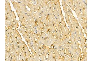 anti-Phosphoinositide 3 Kinase, p85/p55 (PI3K p85/p55) (Internal Region) antibody