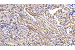 Detection of MCSFR in Mouse Kidney Tissue using Polyclonal Antibody to Colony Stimulating Factor Receptor, Macrophage (MCSFR) (CSF1R antibody  (AA 639-868))