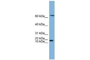 GM2A antibody used at 1 ug/ml to detect target protein. (GM2A antibody  (N-Term))