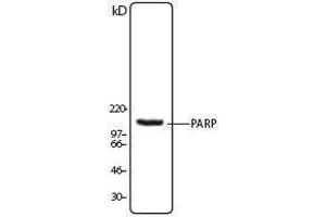 Western Blotting (WB) image for anti-Poly (ADP-Ribose) Polymerase 1 (PARP1) antibody (ABIN2666361) (PARP1 antibody)