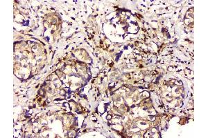 IHC analysis of GPX1 using anti GPX1 antibody (ABIN6719520).